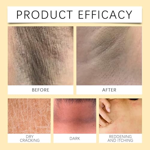 IZBEAUVO Skin Brightening Capsules, Vitamin E Capsules For Face, Vitamin E Oil For Skin, Firming Hydrating Serum, Reduce Fine Lines Skin Brightening, Anti Wrinkle Face Serum, 30 Capsules - Image 3