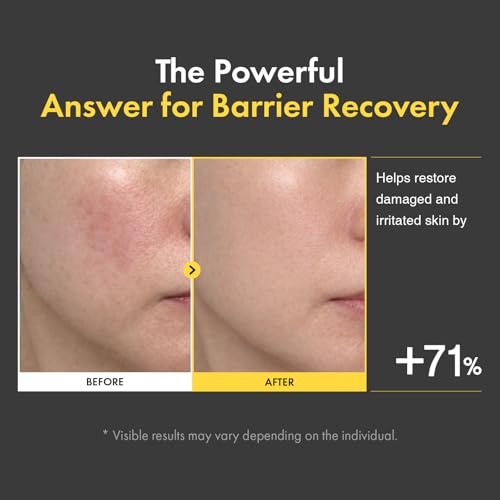 Image of TOSOWOONG Ceramide Barrier Cream for Dry & Sensitive Skin, Hydrating, Dewy