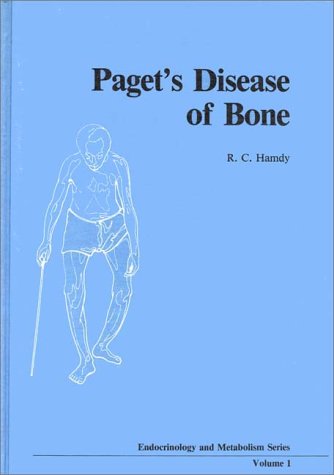 Paget's Disease of the Bone: Assessment and Management : Hamdy: Amazon ...