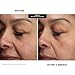 Kate Somerville Mega-A Skin Transforming Serum – Anti-Aging Serum with Hyaluronic Acid For Uneven Texture and Wrinkles, 1 Fl. Oz
