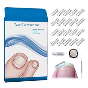 巻き爪用 ケアセット 楽天市場】巻き爪 矯正 セット サポート 器具 【20分だけ改善