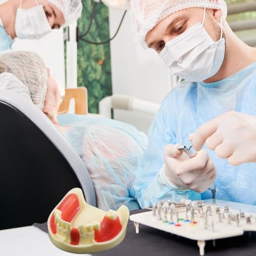 Modèle dentaire mandibulaire pour implants avec gencive pour réalisation de lambeaux - 5