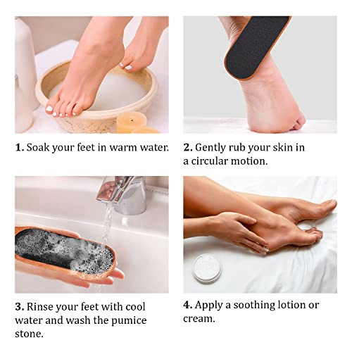 Pumice Stone Foot File - Wooden Pedicure Feet Scrubber With Handle For Callus, Dry, And Dead Skin Removal - Heel Scraper For Feet, Hands, And Body - Foot Filer For Use In Shower #TOP3