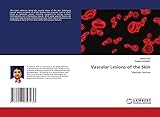 quamar q50e bedienungsanleitung  Vascular Lesions of the Skin: Vascular Lesions