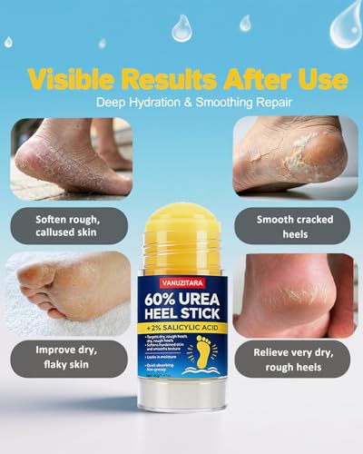 VANUZITARA Urea Cream 60% with 2% Salicylic Acid, Foot Cream 60 Percent for Feet & Hands, Maximum Strength Urea Stick for Rough, Dry Cracked Feet Hands Elbows, Callus Remover, Skin Softener Balm 1.41oz