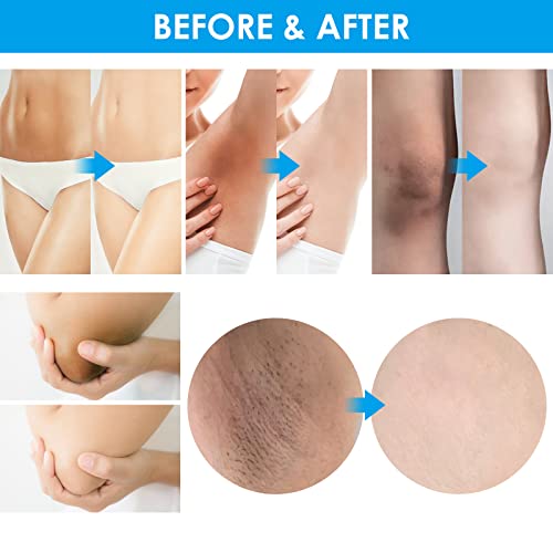 Intimate Skin Lightening Cream, Bleaching Cream For Private Area, Natural Whitening Cream For Underarms, Knees, Elbows, Inner Thigh, Bikini Line, Armpit, Instant Result Dark Spot Corrector Cream 2Oz #TOP2