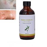 Nutrición: la solución perfecta para hidratar y nutrir la piel de la cara y el cuerpo, curar cicatrices y otras imperfecciones de la piel, como el acné, etc. También sirve como un remedio natural para fortalecer las uñas frágiles y suavizar las cutículas.Este aceite de masaje orgánico también es un tratamiento perfecto para el dolor muscular.