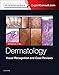 Dermatology: Visual Recognition and Case Reviews