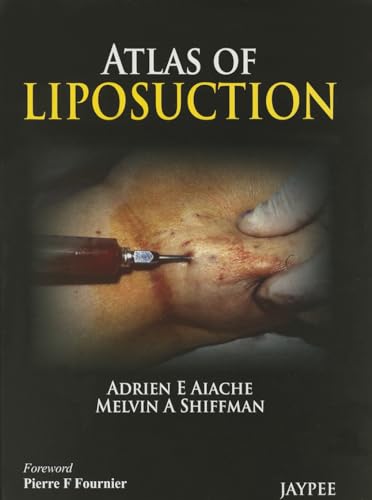 Atlas of Liposuction
