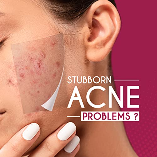 SESA Acne Relief Juice 1 litre| Helps Prevent Pimples I For Acne Prone Skin | Natural Blood Purifier INo Added Sugar, Colour or Flavour - Image 2