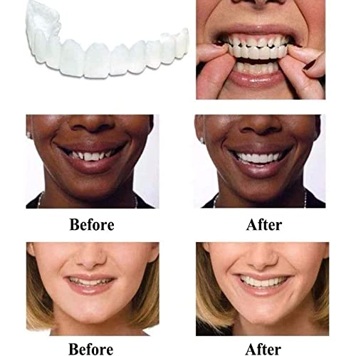 Fake Teeth,Veneers Teeth For Women And Men Used To Cover Missing, Material, Irregular,Teeth（2Pc） #TOP7