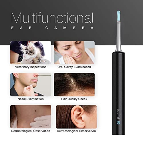 image for BEBIRD Ear Wax Removal, Ear Cleaner with Camera Wireless Otoscope with