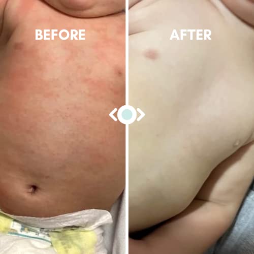 image for Oatmeal Baby Bath Powder for Eczema by Irene Organics - Colloidal Oatm