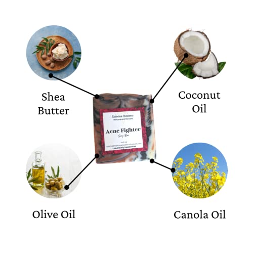 Acne Fighter Soap Bar| Vegan, Natural And Handmade For Body And Face| Help Reduce Back Acne, Blackheads| Shea Butter, Rose Clay, Activated Charcoal| For All-Skin Types| Helps Soothe Eczema & Psoriasis #TOP3