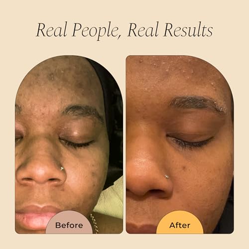 Image of Glo Melanin Turmeric Brightening Soap with Vitamin C, Alpha Arbutin & Oats