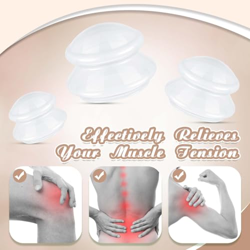 Image of TrelaCo 6 Pcs Silicone Cupping Kit for Massage Therapy,Milky | Cupping Cups 3 Sizes, Suction Therapy for Body Massage Myofascial, Relieves Cellulite Muscle Pain Tension, Studio Household