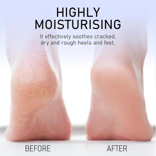 HJXUQIME 2Pcs Crack Feet Prevention Stick, Moisturizing and Hydrating Foot and Hand Balm, Remove Dead Skin Softening and Nourishing Anti-Cracking Foot Cream for Feet Elbows Knees - Image 2