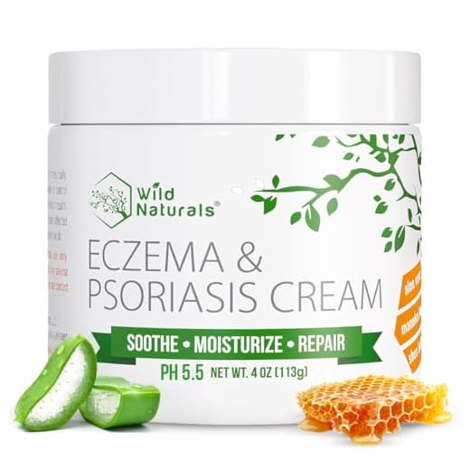Wild Naturals Eczema Psoriasis Cream - for Dry, Irritated Skin, Natural 15-in-1 Lotion Soothes, Moisturizes, and May Visibly Reduce the Appearance of Redness, for Adults, Kids, and Baby, Steroid-Free