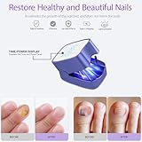 SanFangyue Nail Fungus Laser Treatment Device, 940nm Infrared & 500nm Blue Light for Fast-Acting Fungal Nail Care, Portable & Rechargeable Home Use (Blue) - Image 4