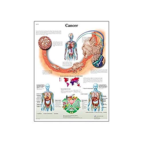 Image of 3B Scientific VR3753L Glossy UV Resistant Laminated Paper Cancer Anatomical Chart (Cancer Anatomical Chart, Spanish), Poster Size 20 inch Width x 26 inch Height