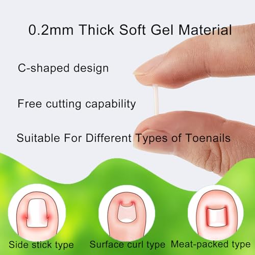 Set zur Korrektur eingewachsener Zehennägel, 62 Stück Schmerzfreie Zehennagelglättungsstreifen mit Zehennagelheber und Nagelklipper, einfaches Werkzeugse