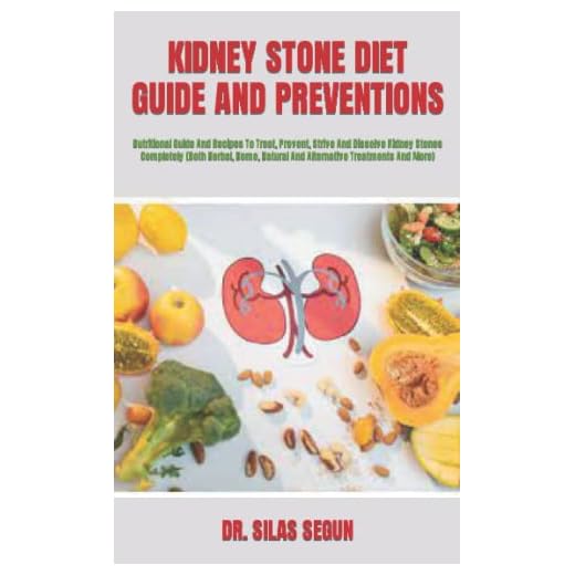KIDNEY STONE DIET GUIDE AND PREVENTIONS: Nutritional Guide And Recipes To Treat, Prevent, Strive And Dissolve Kidney Stones Completely (Both Herbal, Home, Natural And Alternative Treatments And More)