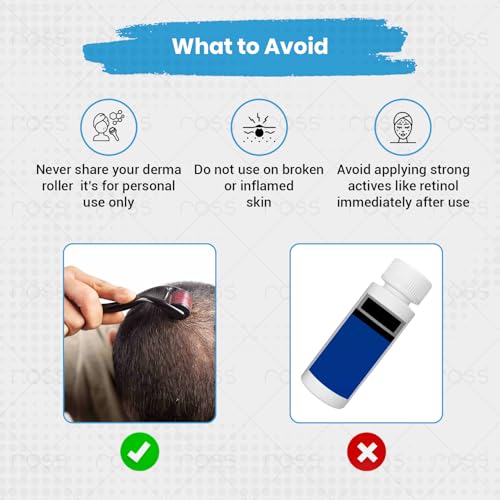 Image of Ross Derma Roller 0.5mm with 540 Stainless Steel Needles - Microneedling Tool for Hair Growth & Thickening, Beard Growth, Skin Repair, Acne Scar Reduction, Fine Line Reduction & Better Skincare Absorption (Black)