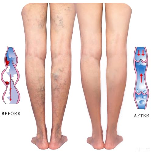 Image of Lin Performance 20-30 mmHg Medical Calf Compression Sleeve for Women and Men Lightweight Footless Socks for Travel Flight Daily Comfort