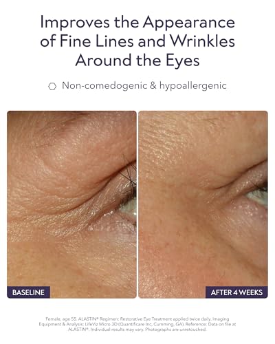 Image of ALASTIN Skincare Restorative Eye Complex (0.5 oz)
