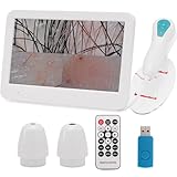 Beauty Star Scalp Analysis Machine, 12 inches Skin Tester Diagnosis Digital Analyzer Tool, Profesional Hair Detector Microscope, HairFollicle Health Detection Camera for Head Spa, Salon and Home Use