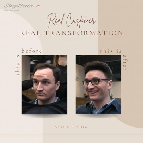 Image of SkyHair 100% Remy Hair Australian Mirage Hair Patch Transparent Poly PU Front and Border, Natural Front Hairline Skin Base for Real Looking Scalp Undetectable Toupee PREMIUM System (Black, 9x6)