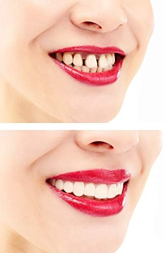 Amazon One Touch Smile ワンタッチスマイル 美容 付け歯 簡易 インスタント 入れ歯 仮歯 義歯 審美歯 歯カバー 上歯 男女兼用 簡単装着 部分付け歯 Lady Lazy 入れ歯ケア用品 通販