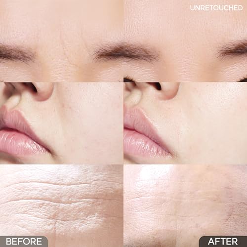 MARSHIQUE Between the Eyes Wrinkle Patches - Gifts for Mom & Dad - Frown Lines Eleven Lines Non invasive Face Wrinkles Smoothers - Tape Tox - Korea Beauty Care, 55 Patches