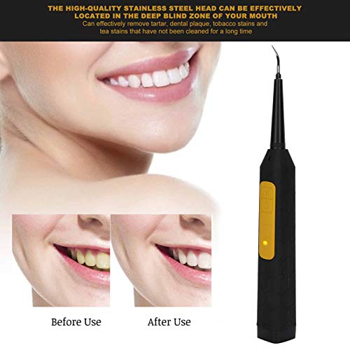 Limpador de dentes, limpador de dentes USB profissional, removedor de cálculos elétrico, removedor p