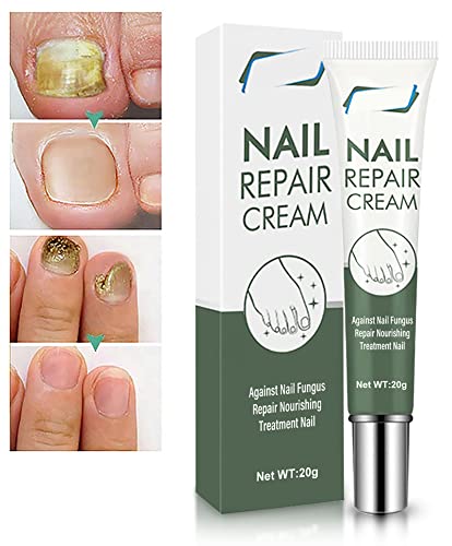 Nail Repair Cream, Effective Toenail Fungus Treatment Gel Foot Nail Growth Cuticle Cream - Restores The Healthy Appearance of Nails