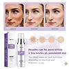HANYWIL Dark Spot Remover for Face & Body Serum with Retinol & Niacinamide - Corrects Melasma, Sun & Age Spots, Hyperpigmentation Treatment for All Skin, Dermatologist Tested (1.7 Fl Oz) #5