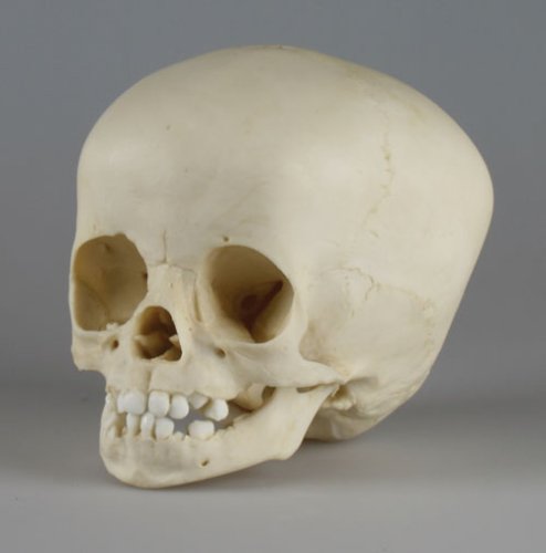 Erler-Zimmer 4770 Skull Model Child 1 Year Old