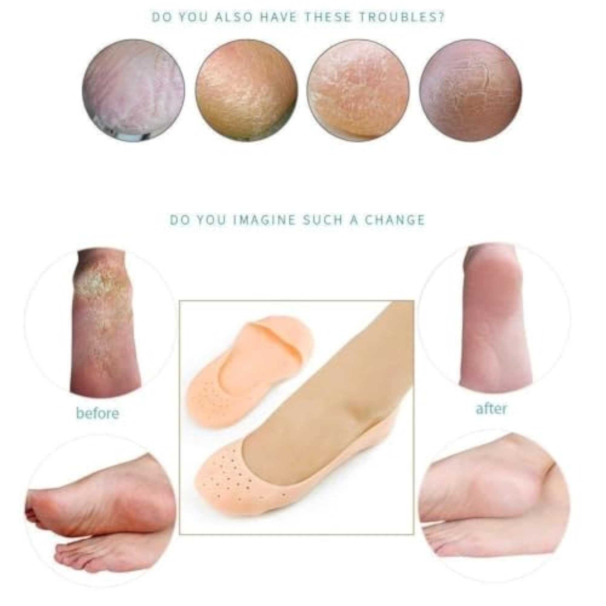 Anti-Crack Full Length Silicone Foot Protector Socks
