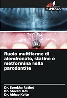 Ruolo multiforme di alendronato, statine e metformina nella parodontite 6208695937 Book Cover