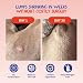 Fifth & Fido Turkey Tail Mushroom for Dogs – Lipoma Treatment for Dogs - Mushroom Supplement with Immune Support for Lipoma, Lumps & Bumps – Premium Pet Vitamins and Supplements Made in USA, 100 Serv.