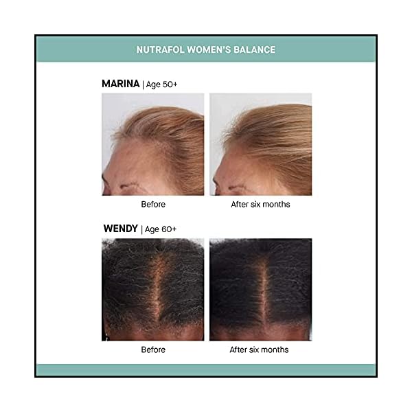 Nutrafol-Womens-Balance-Hair-Growth-Supplement-for-Thicker-Stronger-Hair-Peri-and-Post-Menopause-1-Month-Supply Nutrafol Women's Balance Hair Growth Supplements, Ages 45 and Up, Clinically Proven for Visibly Thicker Hair and Scalp Coverage, Dermatologist Recommended - 1 Month Supply