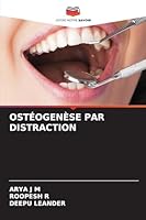 Ostéogenèse Par Distraction 6208701619 Book Cover