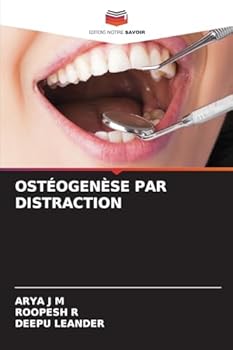 Paperback Ostéogenèse Par Distraction [French] Book