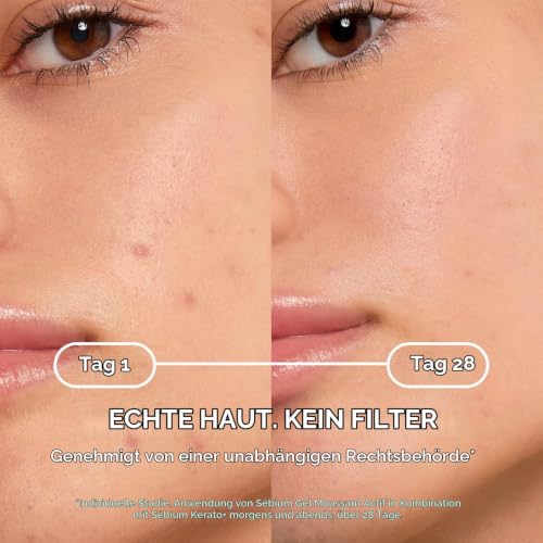 BIODERMA Sébium Kérato+ - beseitigt Pickel und Mitesser - Creme gegen Hautunreinheiten - zu Akne neigende Haut - von Dermatologen empfohlen… – Ansicht 6