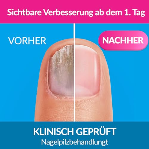 Excilor Intensiv Lack gegen Nagelpilz, 30 ml Lösung