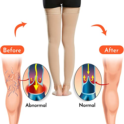 Image of Compression Sock, Morelian 1 Pair Thigh High Socks Men Women 20-30mmHg Stockings Sleeves for Varicose Vein Swelling