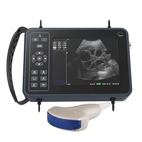 超音波検査装置（エコー） 竹田乳腺クリニック | 大阪府守口市 乳腺専門医 乳がん検診