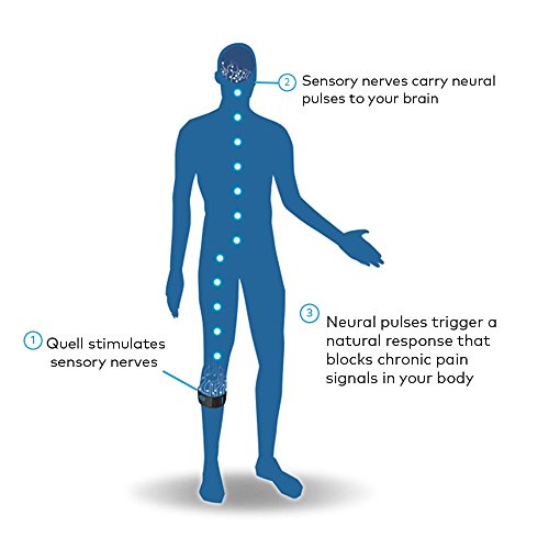 Quell 2.0 Wearable Pain Relief Technology