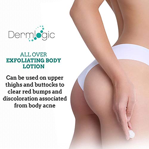 Keratosis Pilaris Treatment- Get Rid Of Kp, Bumps & Body Acne. 12% Lactic Acid Lotion. Moisturizing Repair Cream Smooths Rough, Dry, Cracked, Bumpy Skin & Redness. #TOP2