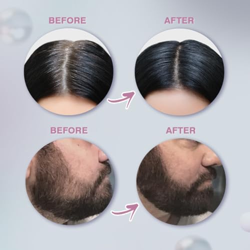 Image of Glamveda Cover-Up Hair Powder Black | Instantly Covers Grey Roots, Bald Spots & Thinning Hair | Hairline Filler for Fuller & Denser Looking Hair | Highly Pigmented Matte Finish | Long-Lasting Coverage | 4g